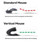 Illustration comparing a standard mouse and a vertical mouse. The standard mouse shows red arrows indicating pressure and discomfort from wrist to hand. The vertical mouse shows green arrows indicating reduced pressure and cramping relief.